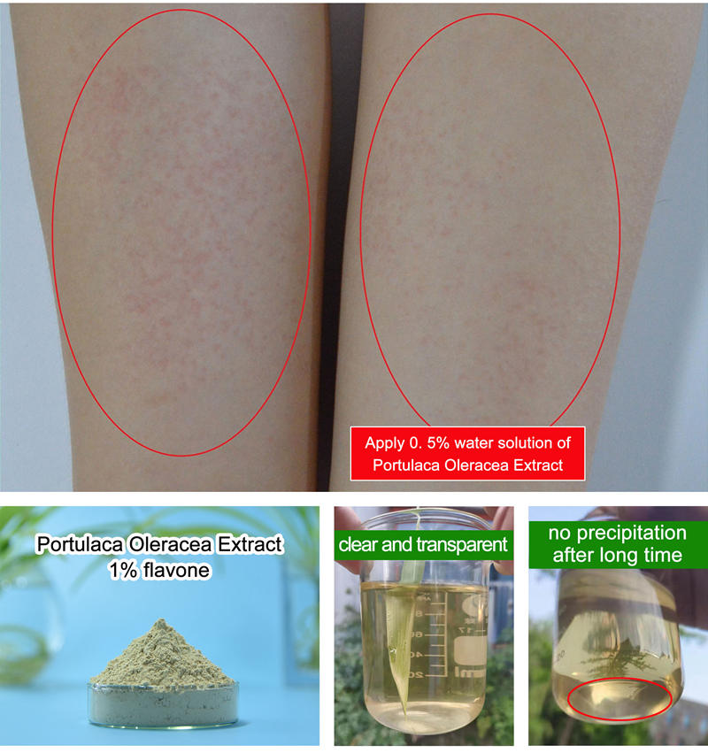 Portulaca oleracea extract anti-allergy