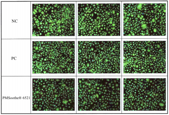 TRPV1 protein immunofluorescence staining results 1