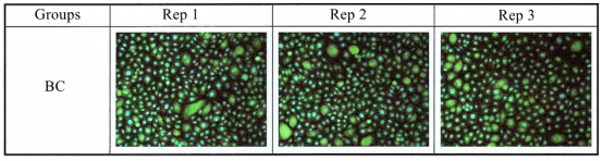 TRPV1 protein immunofluorescence staining results
