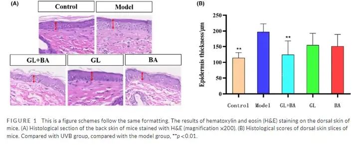 Glabridin+Bakuchiol inhibits epidermal hyperplasia