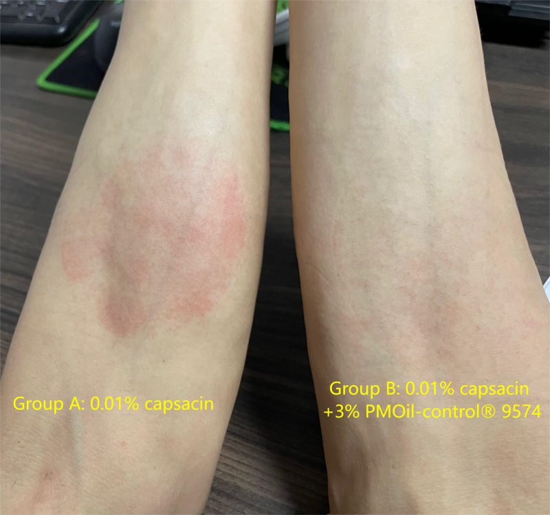 human capsacin test